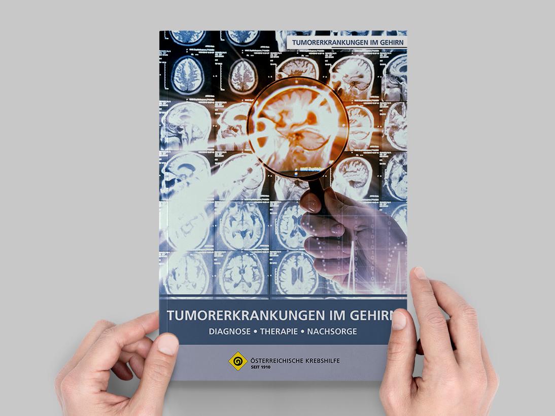 Tumorerkrankungen - Gehirn Broschüre Tumorerkrankungen - Gehirn