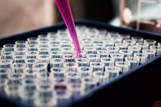 Reagenzgläser mit Pipette